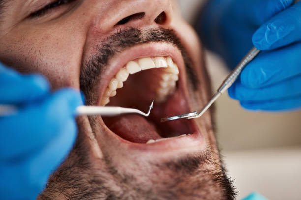 Best Emergency TMJ Treatment in Bolivar Peninsula, TX
