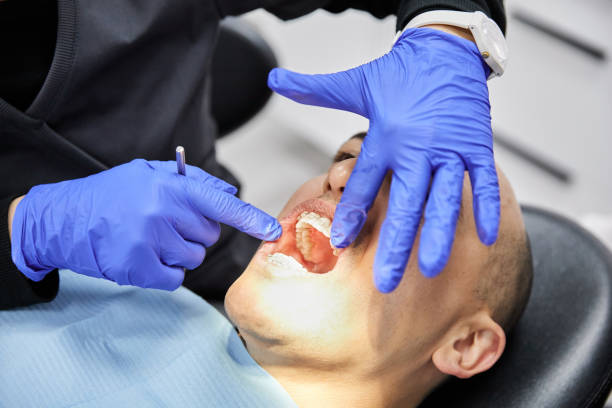 Best Emergency Wisdom Teeth Removal in Bolivar Peninsula, TX